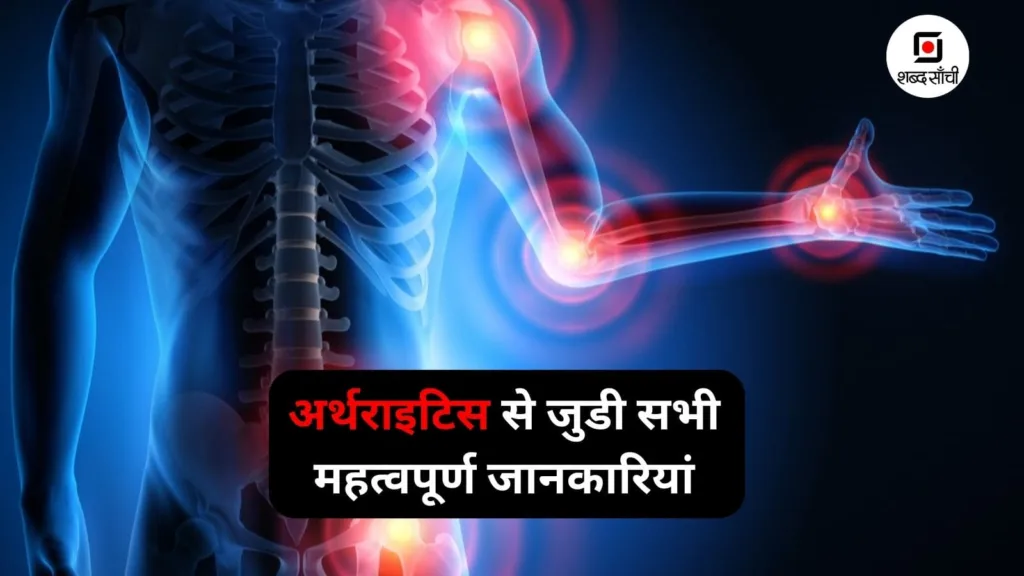 Arthritis Disease Meaning, Causes In Hindi, Gathiya Rog Kya Hai