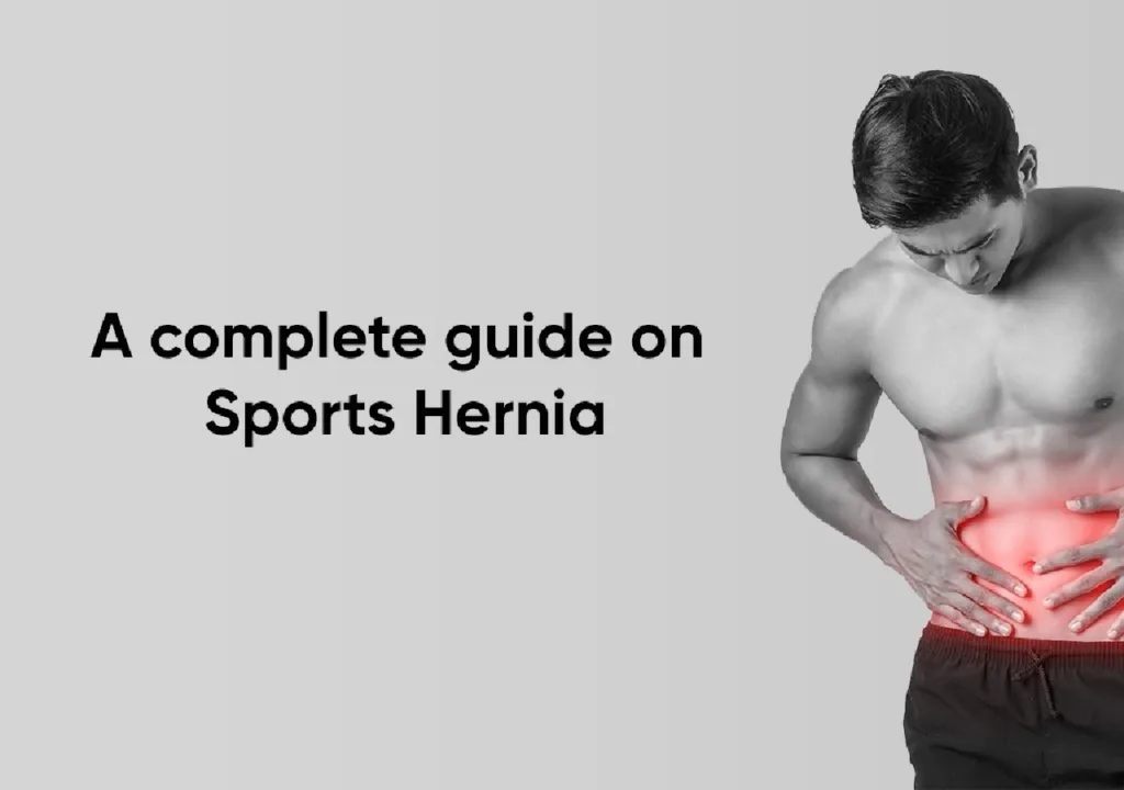 What Is Sports Hernia