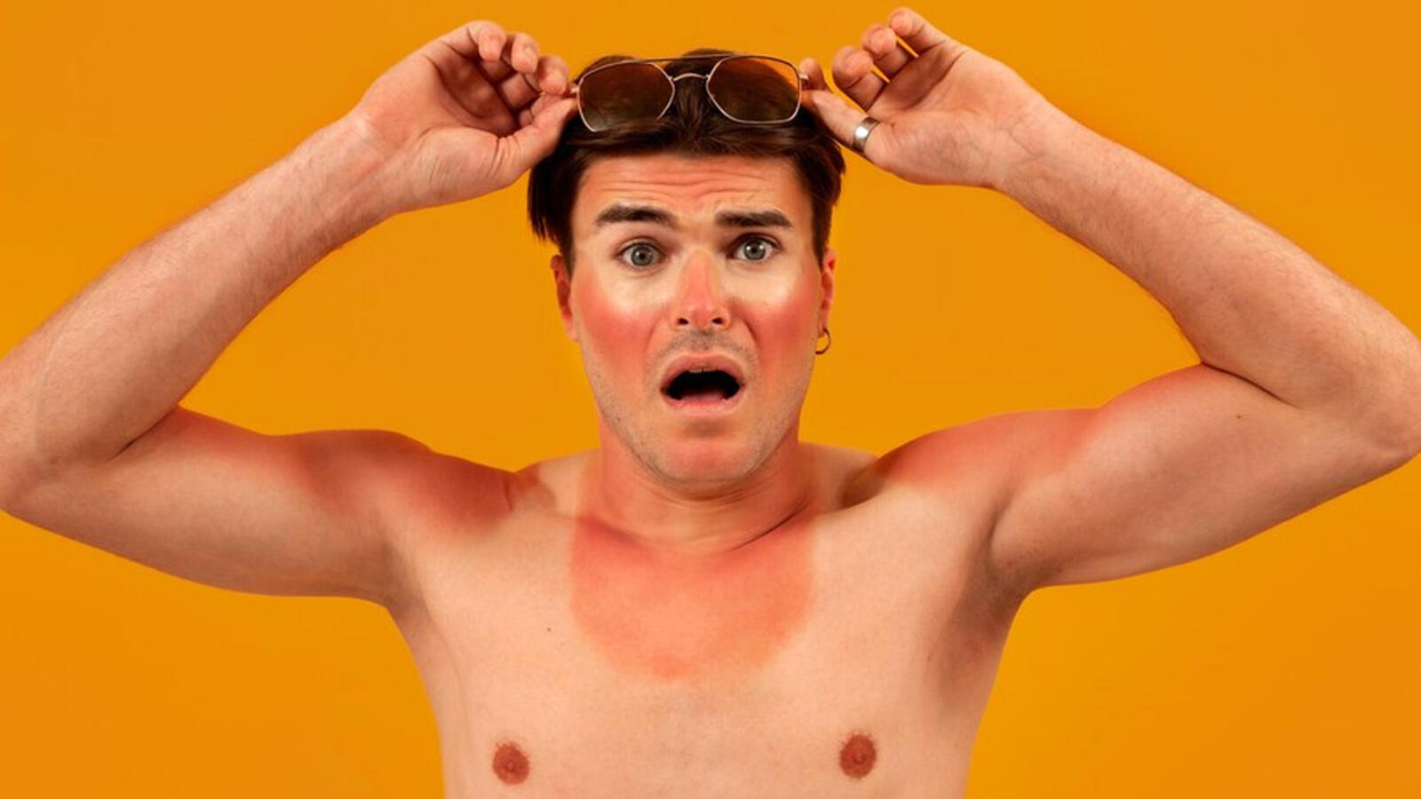 Sun tan removal Ubtan : धूप से आने के बाद त्वचा पर लगा लें यह उबटन, नहीं होगी टैनिंग