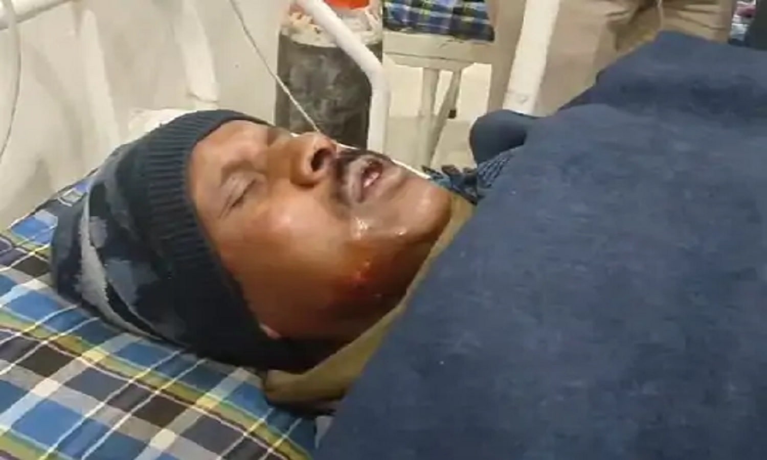 Vindhya: पुलिस आरक्षक के साथ मारपीट और लूट