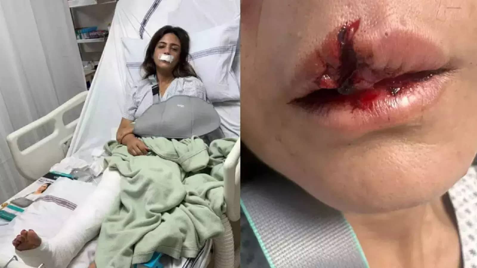 Shweta Rohira Accident | सलमान की बहन का हुआ दर्दनाक एक्सीडेंट, फोटो हुई वायरल
