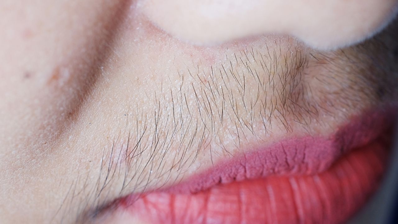 Facial Hair Removal Tips