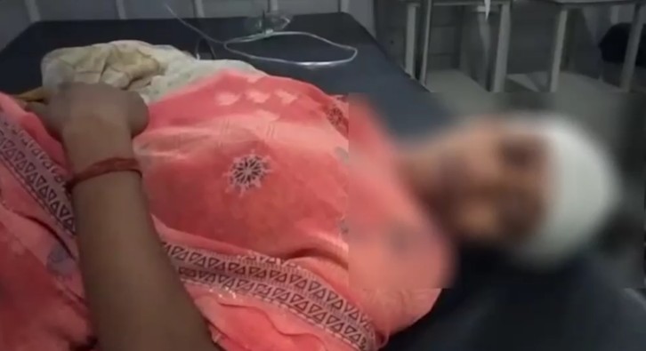 Woman's head broken with stone for protesting against teasing in Rewa
