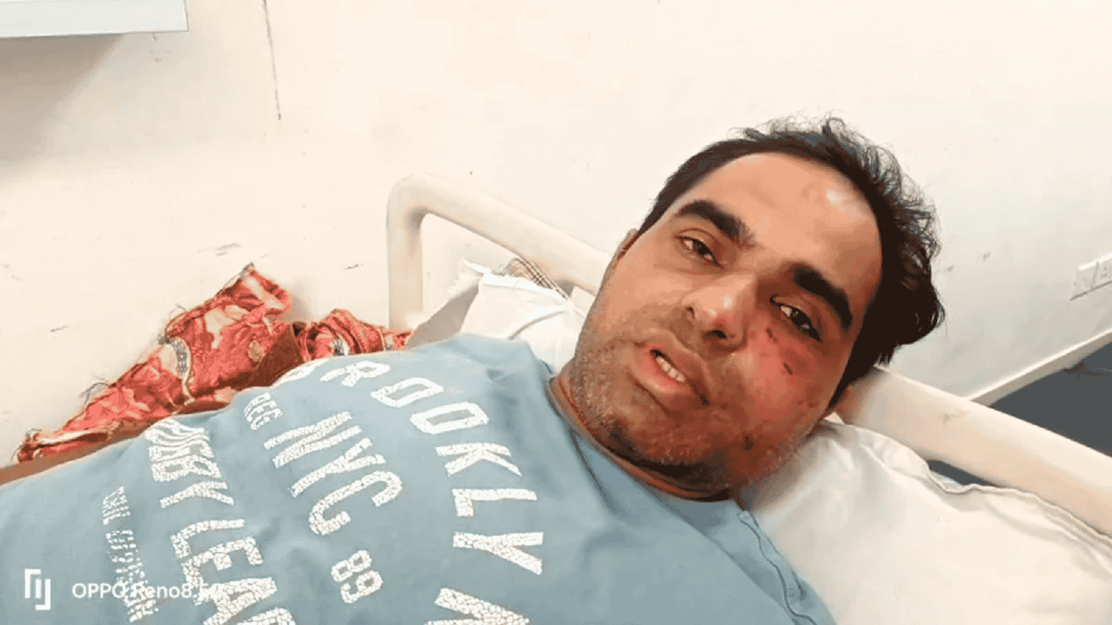 एमपी के शहडोल में पुलिस कर्मियों ने डॉक्टर को पीट-पीट कर किया बेदम, पहले घर के पास फिर थाने में पीटा