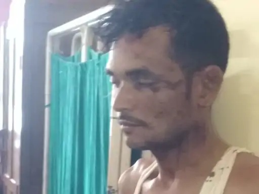 Dispute over delay in cooking food in Sidhi wife beats husband