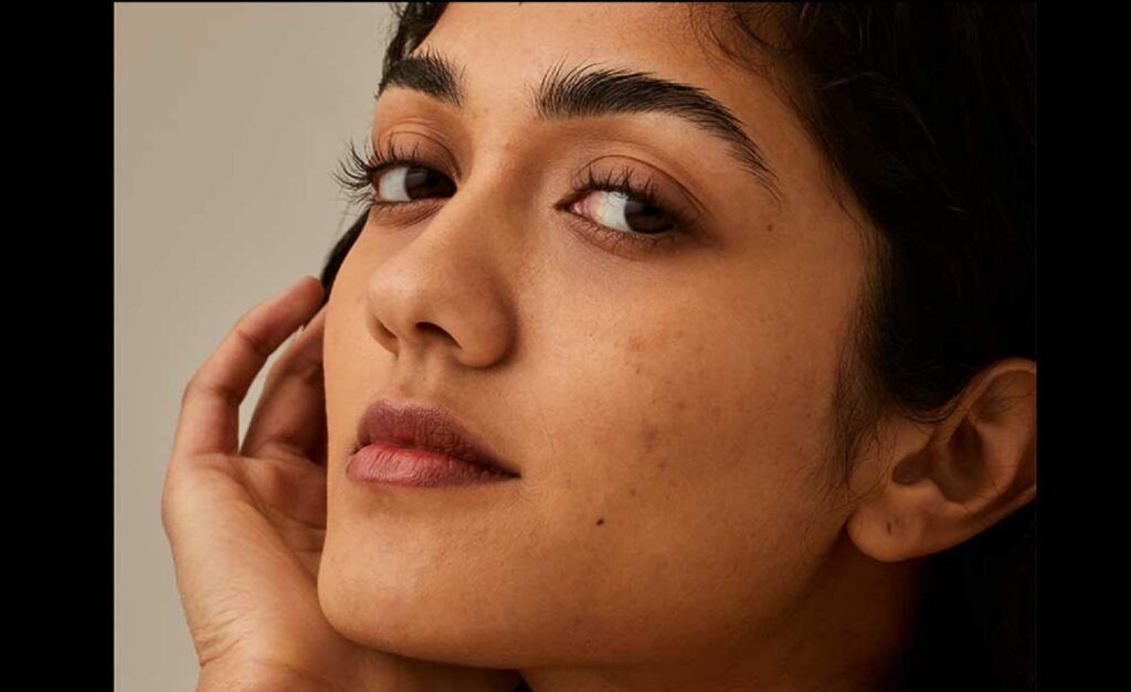 Melasma Cleaning With Home Remedies