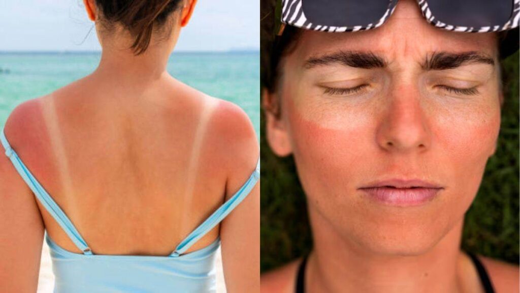 Sun Tanning Tips