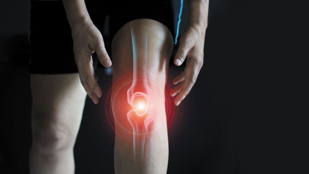 Knee and Joint Pain Remedies and Diet Tips