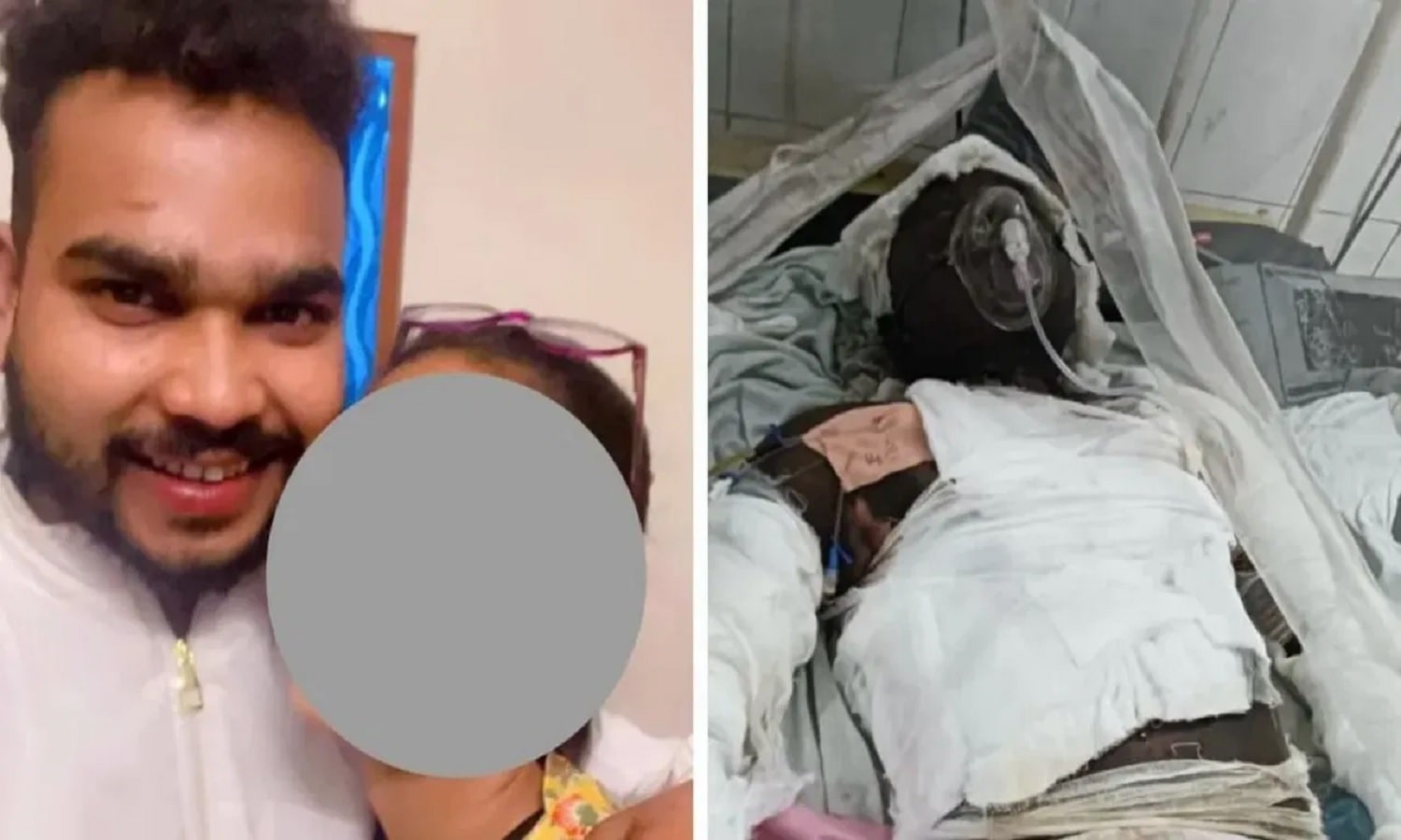 MP: प्रेमी आग में जल रहा था, प्रेमिका बना रही थी वीडियो