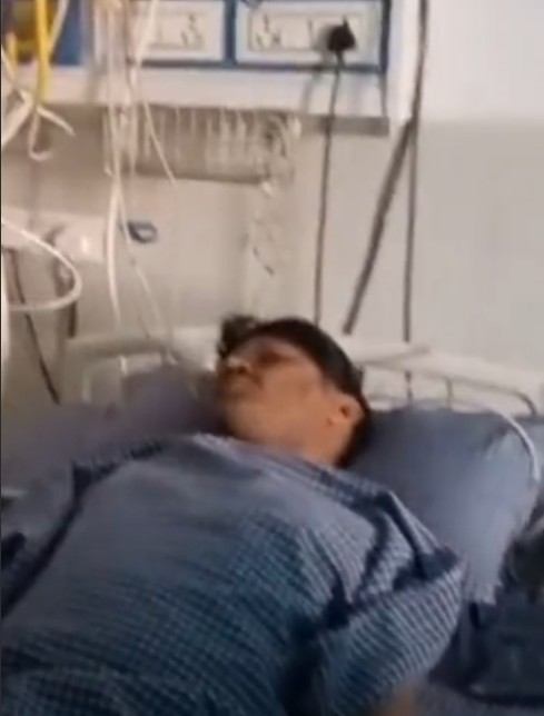 Another worker got burnt in Rewa's Pahadiya garbage plant