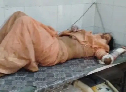 Rewa News: शंकरगढ़ में रोडवेज बस और बाइक की टक्कर, युवक की मौत, पत्नी-बेटा गंभीर रूप से घायल