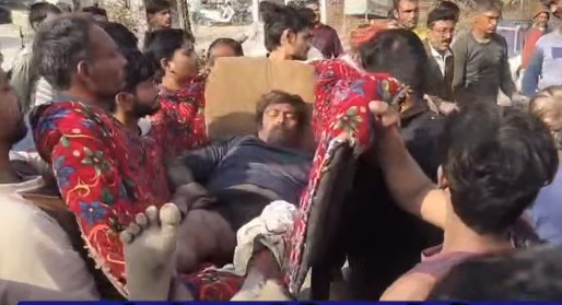 Rewa Transport Nagar Tyre Burst Accident Young Man Injured Serious Condition