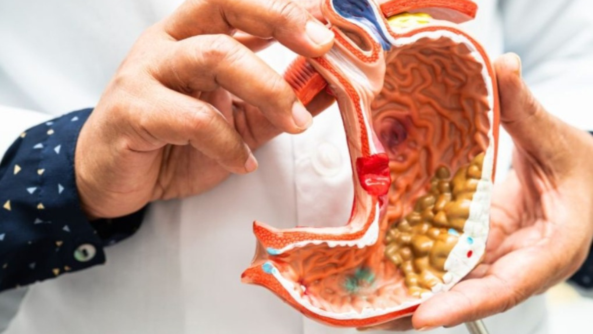 Gallbladder हटने के बाद क्यों बदल जाता है पाचन तंत्र? जाने लक्षण