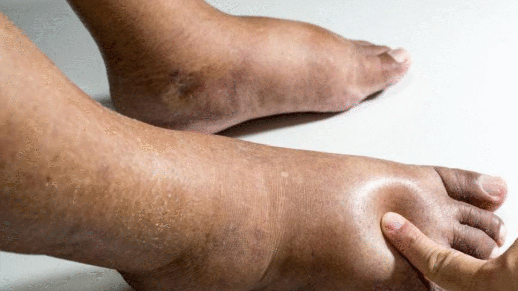 If you see these 7 signs in your feet, you may have diabetes.