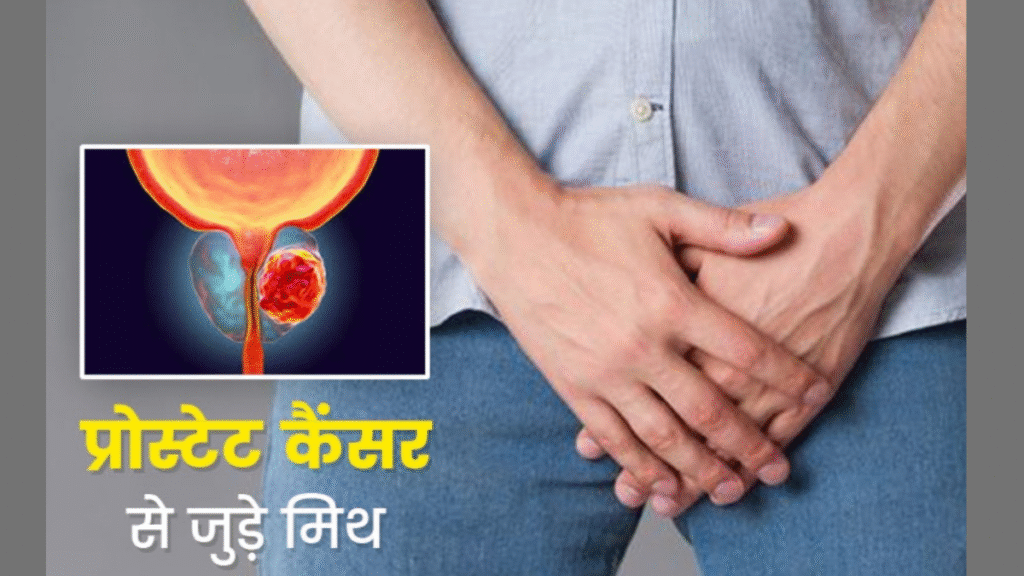 Prostate Cancer: Doctors bust 5 big myths, find out the truth