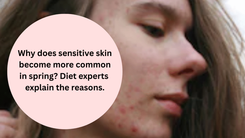 Why does sensitive skin become more common in spring? Diet experts explain the reasons.