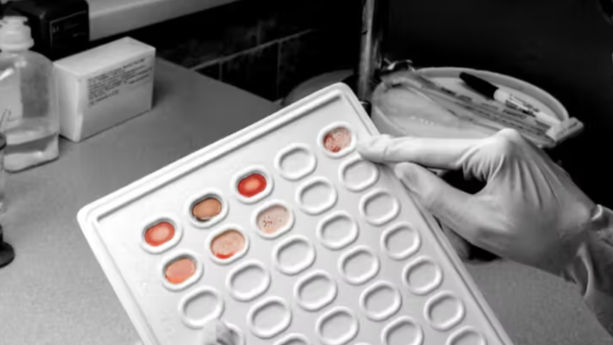 New blood test may help detect cancer early, UCLA study reveals key findings