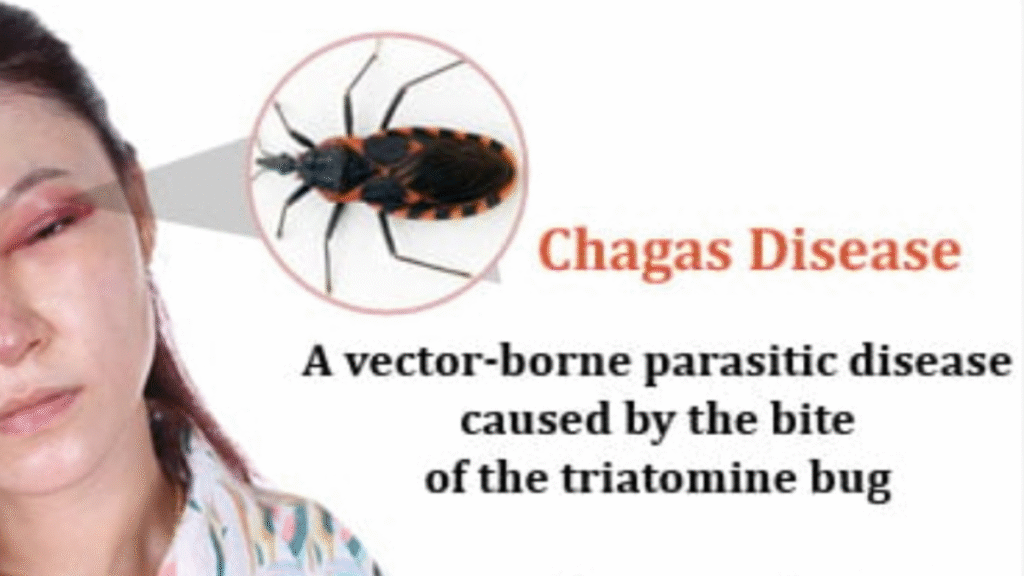 Chagas Disease: A silent infection that can cause serious damage to the heart and body