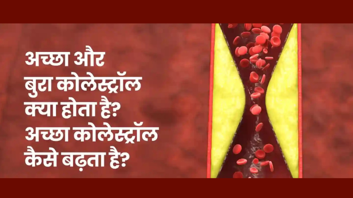 Cholesterol Myth: Is the Understanding of Good and Bad Incomplete?