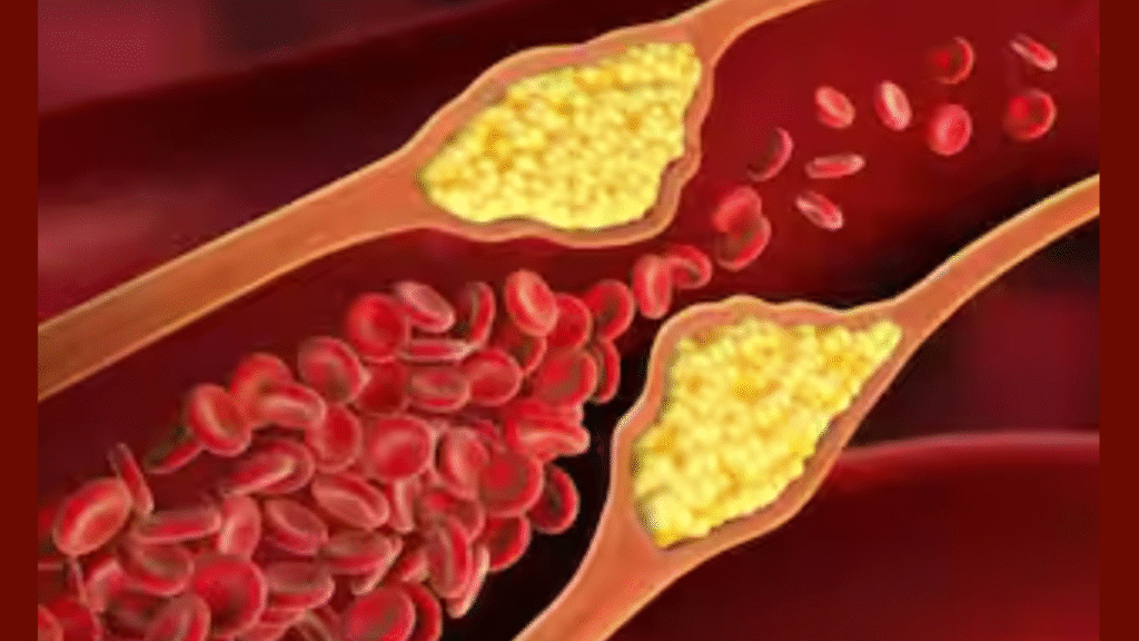 Cholesterol Myth: Is the Understanding of Good and Bad Incomplete?