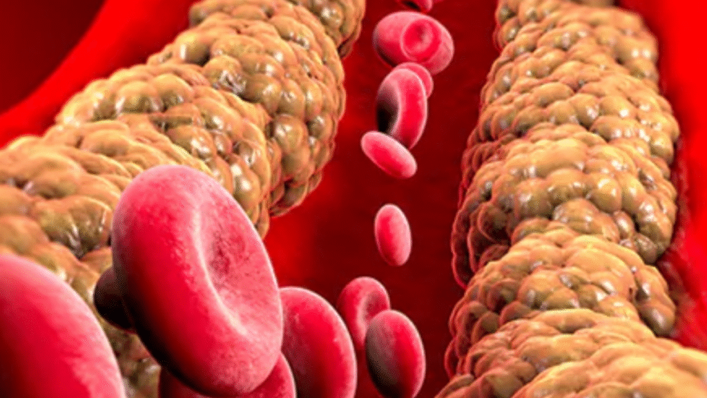 LDL Cholesterol Target: Doctors change standards for heart health