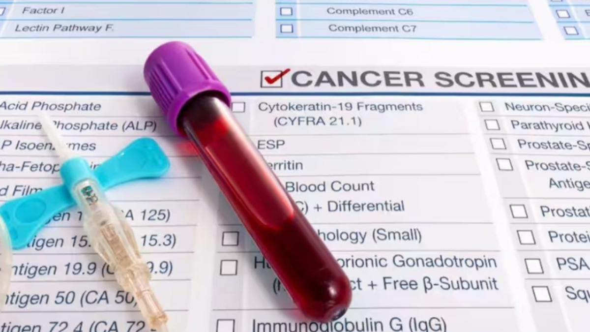 A major change in cancer detection in 2026? New blood test technology raises hopes.