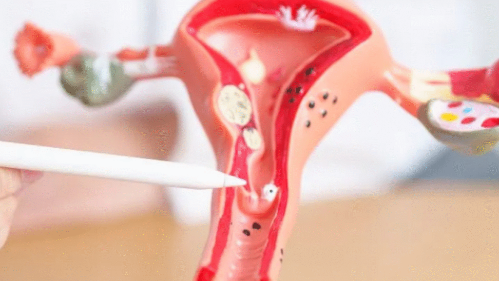 Why awareness about ovarian cancer is important, a major challenge related to women's health