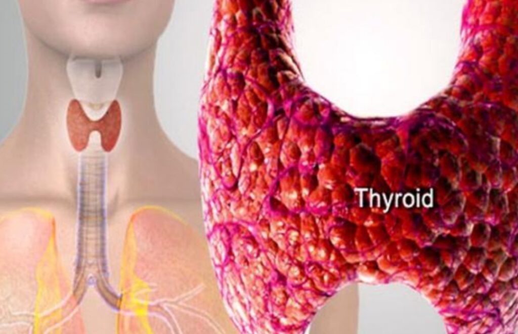 Thyroid Health: Why is it important to limit the consumption of these 8 foods if you have thyroid problems?