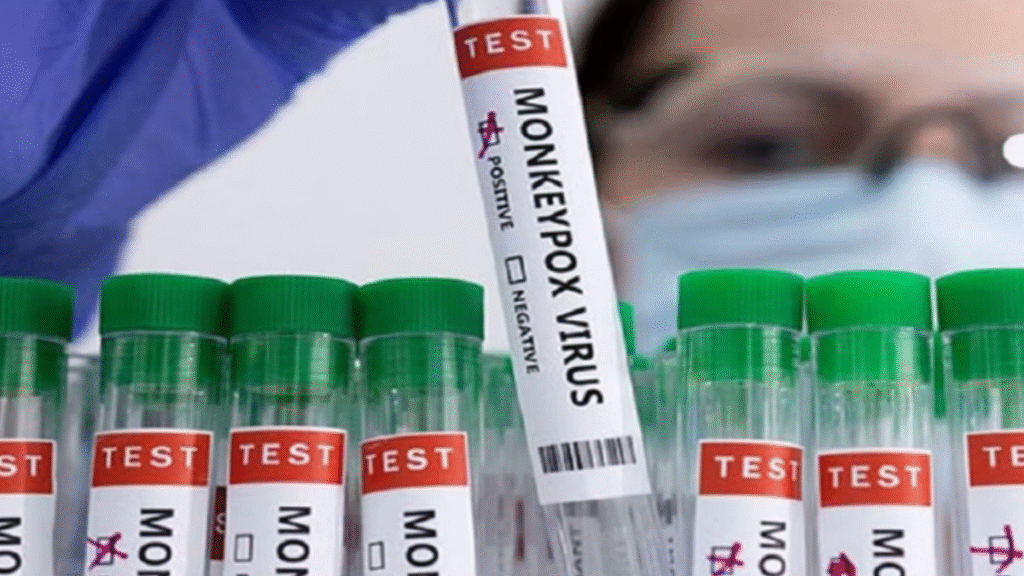 Mpox Virus Case: Two scientists in the US accused of hiding biological samples