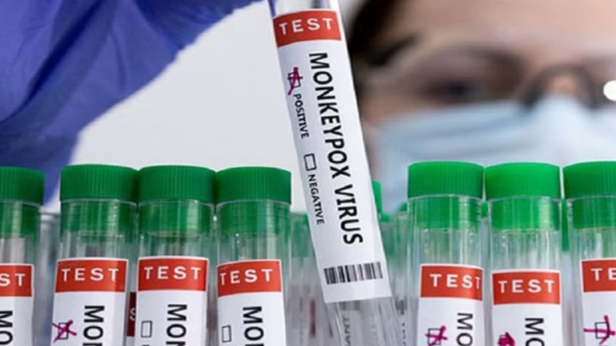 Mpox Virus Case: Two scientists in the US accused of hiding biological samples