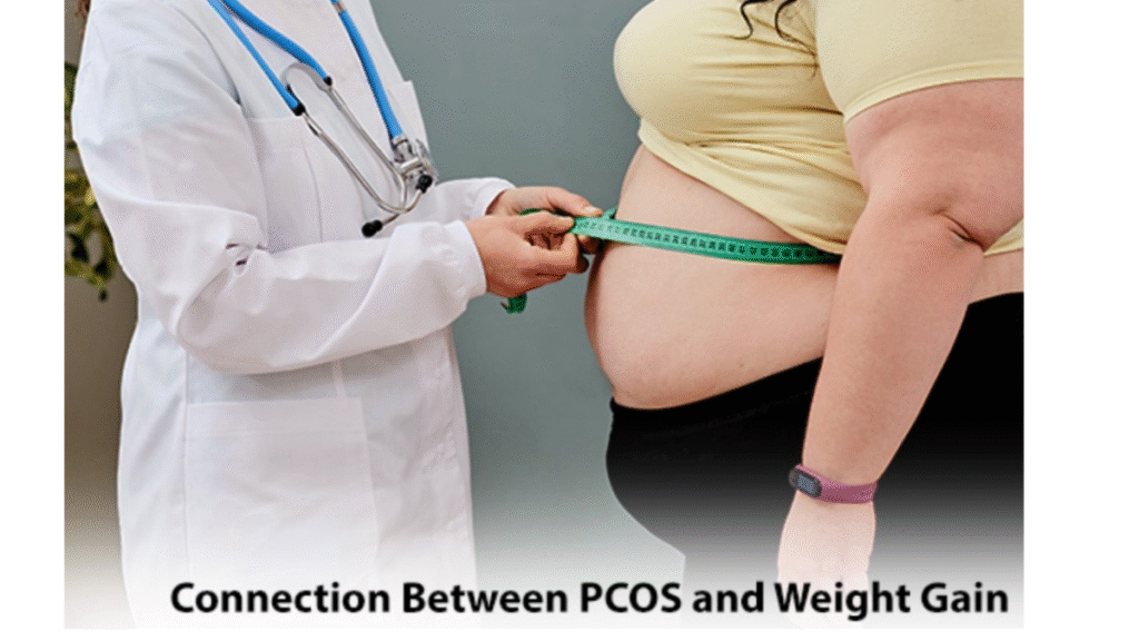 PCOS Weight Gain: Does weight gain cause PCOS? Doctor reveals a new truth.