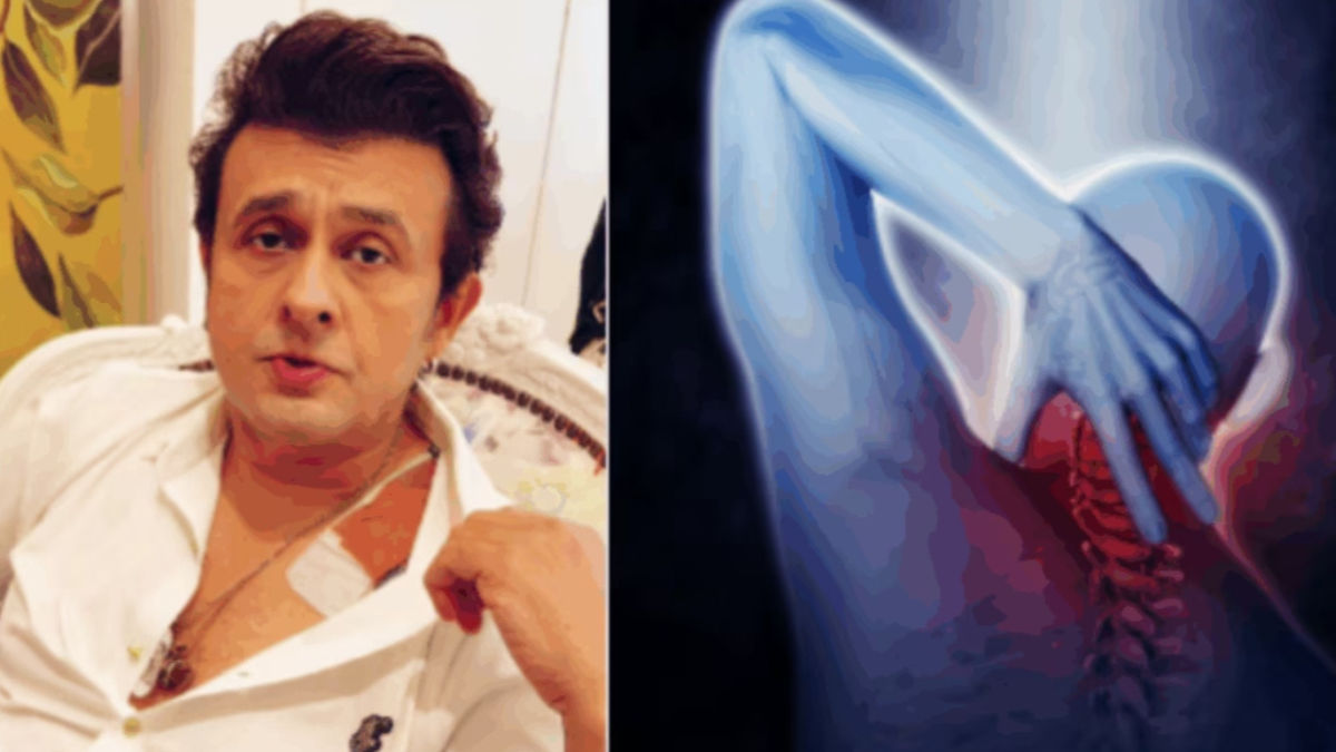 Sonu Nigam Health Update: What is a pinched nerve, and which symptoms should not be ignored?