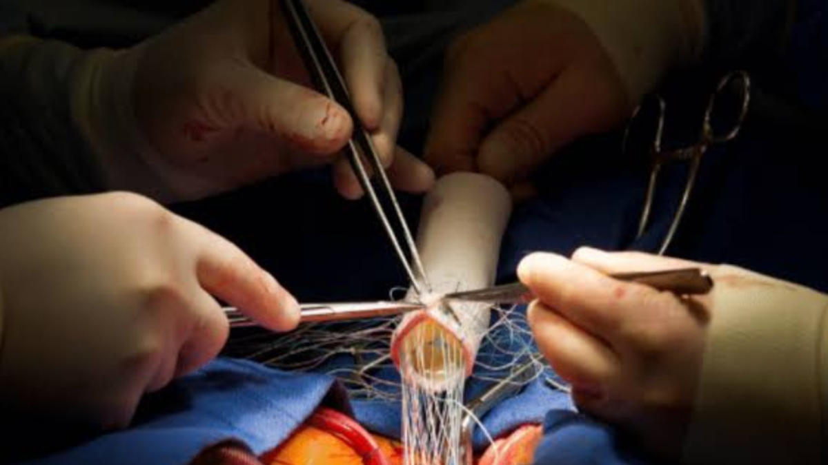 New study reveals that preserving the heart valve during aortic surgery can lead to better outcomes.