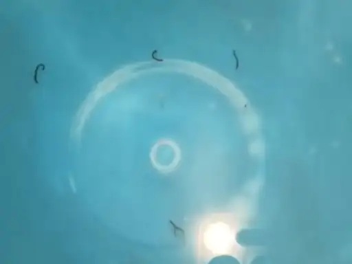 Water containing worms is flowing from taps in Satna.