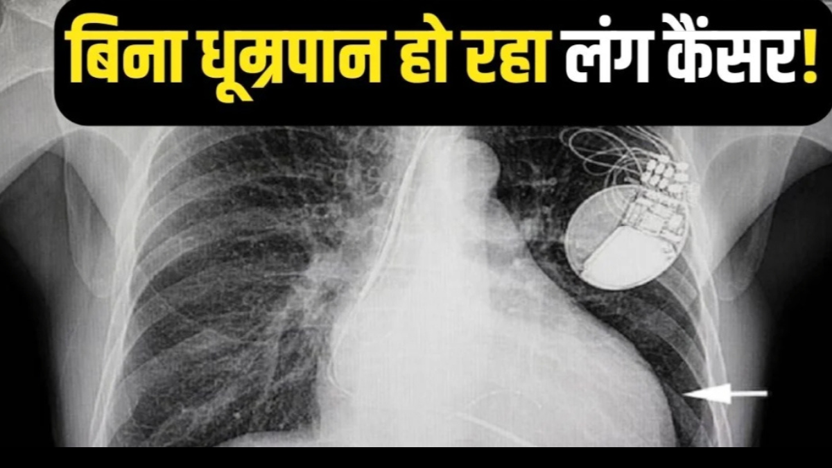 Lung cancer doesn't just affect smokers; these people should also stay alert.