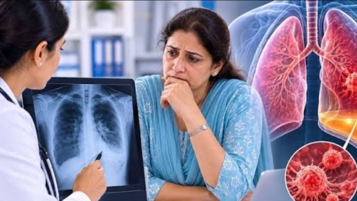 When can a persistent cough, chest pain, and shortness of breath be signs of lung cancer?