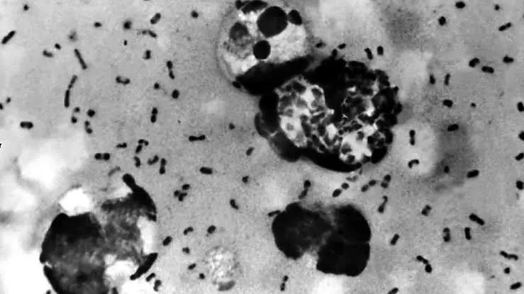 pneumonic plague